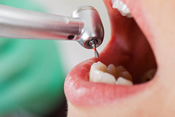 Best Pediatric Emergency Dentist in Normandy, MO